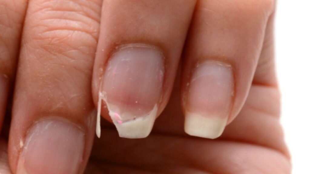 Cómo recuperar la salud de tus uñas tras usar acrílico o gelish: consejos para uñas más gruesas y largas