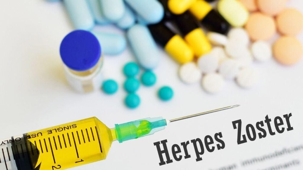 ¿Cuánto tiempo puede sobrevivir el virus del herpes zóster fuera del cuerpo y cómo evitar su transmisión?